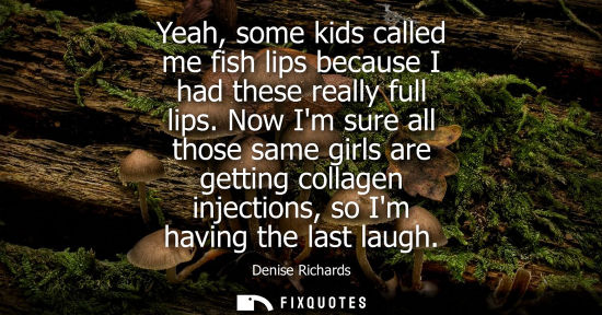Small: Yeah, some kids called me fish lips because I had these really full lips. Now Im sure all those same gi